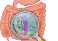 Darmbakterien beeinflussen die Wirkung von Nanomedizin bei Krebs