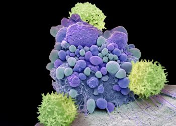 Entdeckung im Schädelknochen: Neue Immunzentren schützen das Gehirn