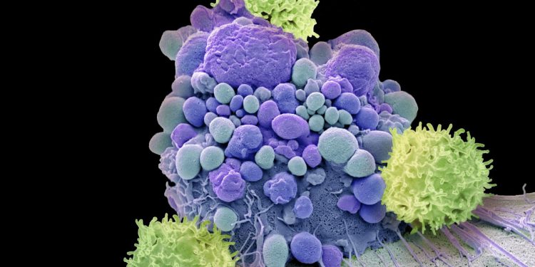 Entdeckung im Schädelknochen: Neue Immunzentren schützen das Gehirn